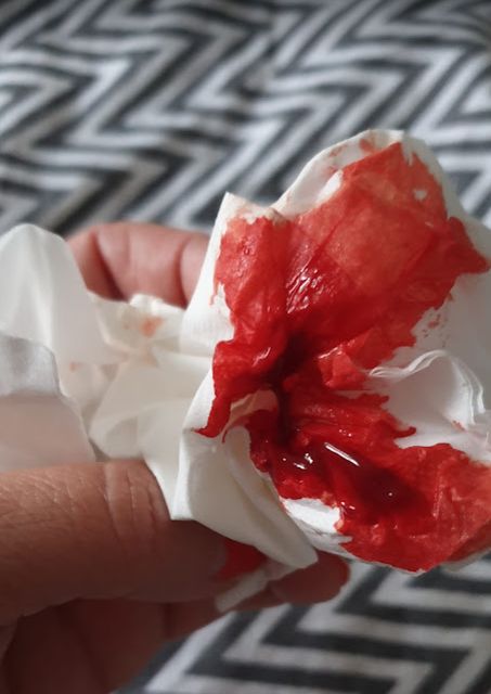 Ein Taschentuch mit Blut
